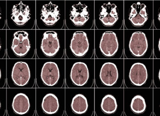map of the brain MRI