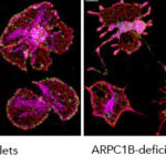 ARPC1B-platelets