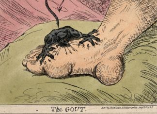 gout illustration