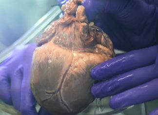 Heart operation
